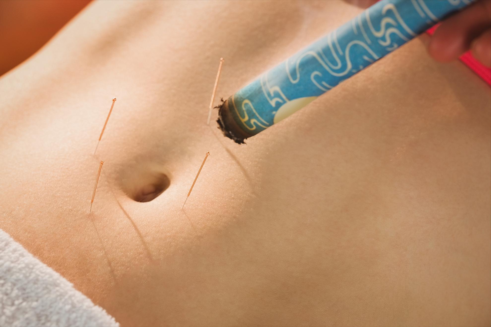 女生肚脐眼下为什么有条黑线,女人肚脐眼下有一条黑线