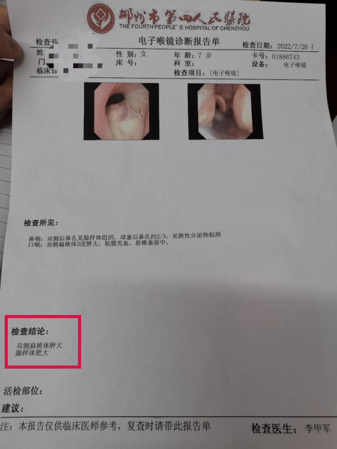 小孩打鼾腺样体肥大怎么保守治疗,小孩老是张嘴呼吸查了腺样体不大