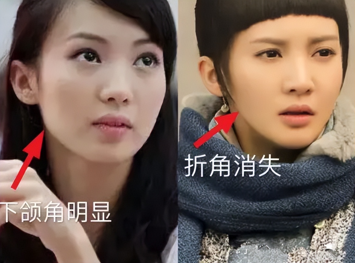 金晨瘦成纸片人现状,金晨看起来好干净