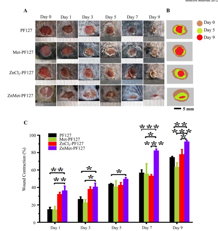 「科研快报」可喷雾热敏水凝胶与锌修饰二甲双胍促进皮肤创面愈合