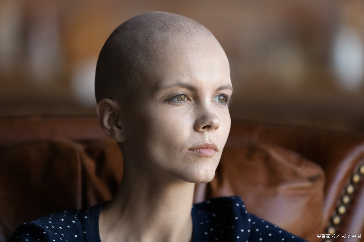 化疗头发掉光意味着什么,头发都快掉光