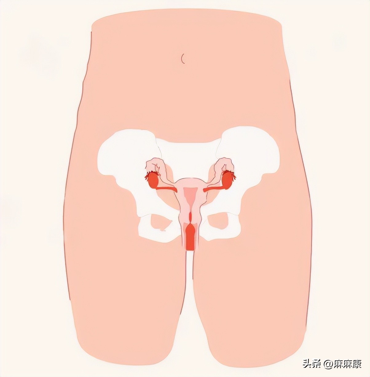 慢性盆腔炎的治疗方法,慢性盆腔疼痛哪治疗好