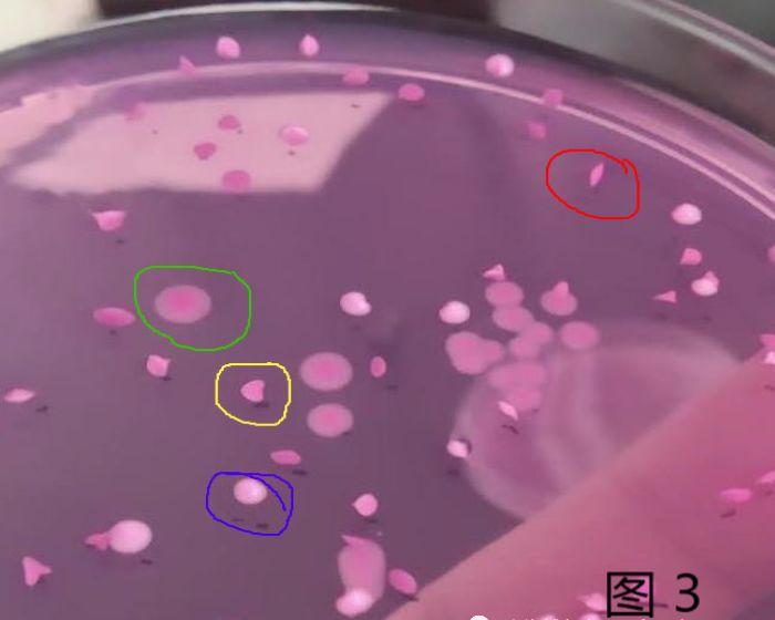 霉菌酵母菌检测方法视频,霉菌和酵母菌的国标检测方法