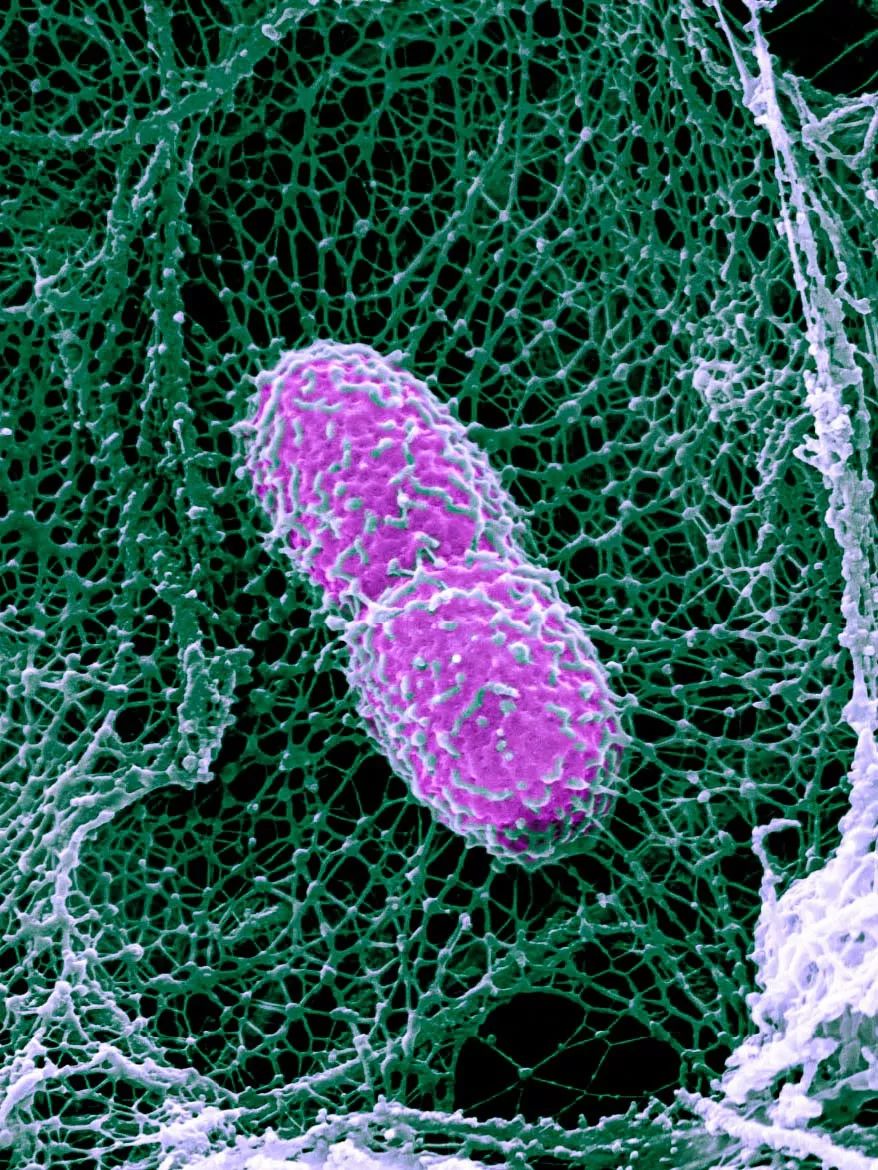致与病毒搏斗的你！