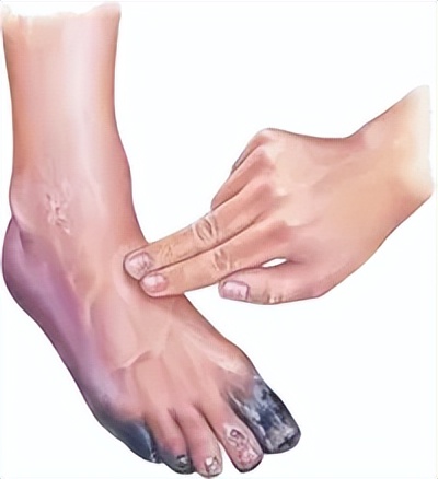 世界糖尿病日小知识,世界糖尿病日活动方案选品