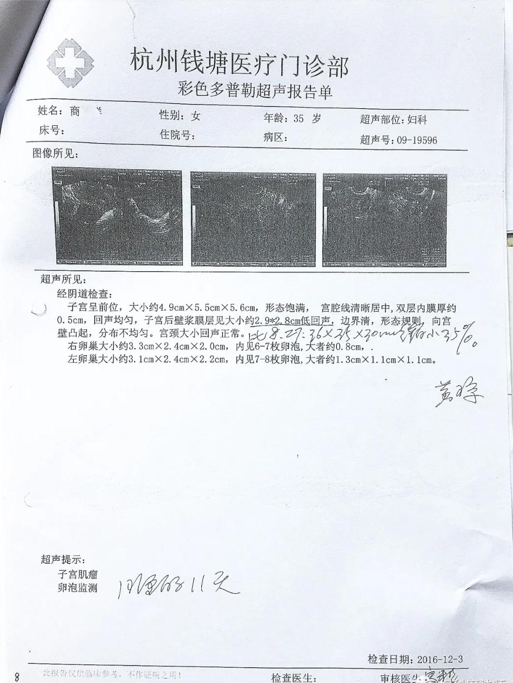 子宫肌瘤10厘米中医医案,国医大师治子宫肌瘤方剂
