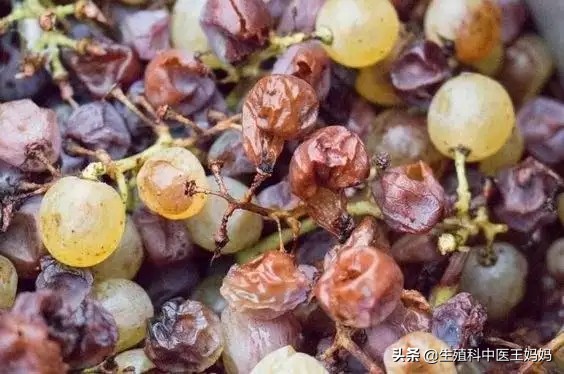 女子被切掉子宫,宫颈糜烂癌变是不是都要切除子宫