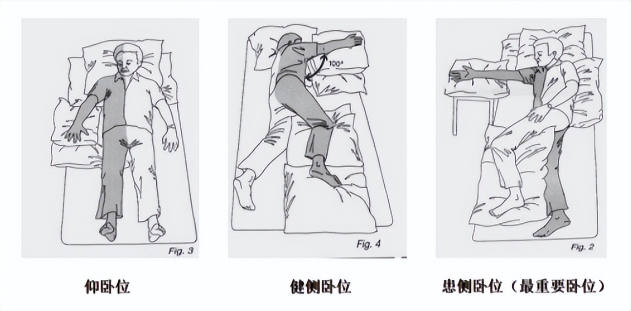 脑卒中主要功能障碍有哪些,脑卒中后认知功能障碍怎么办