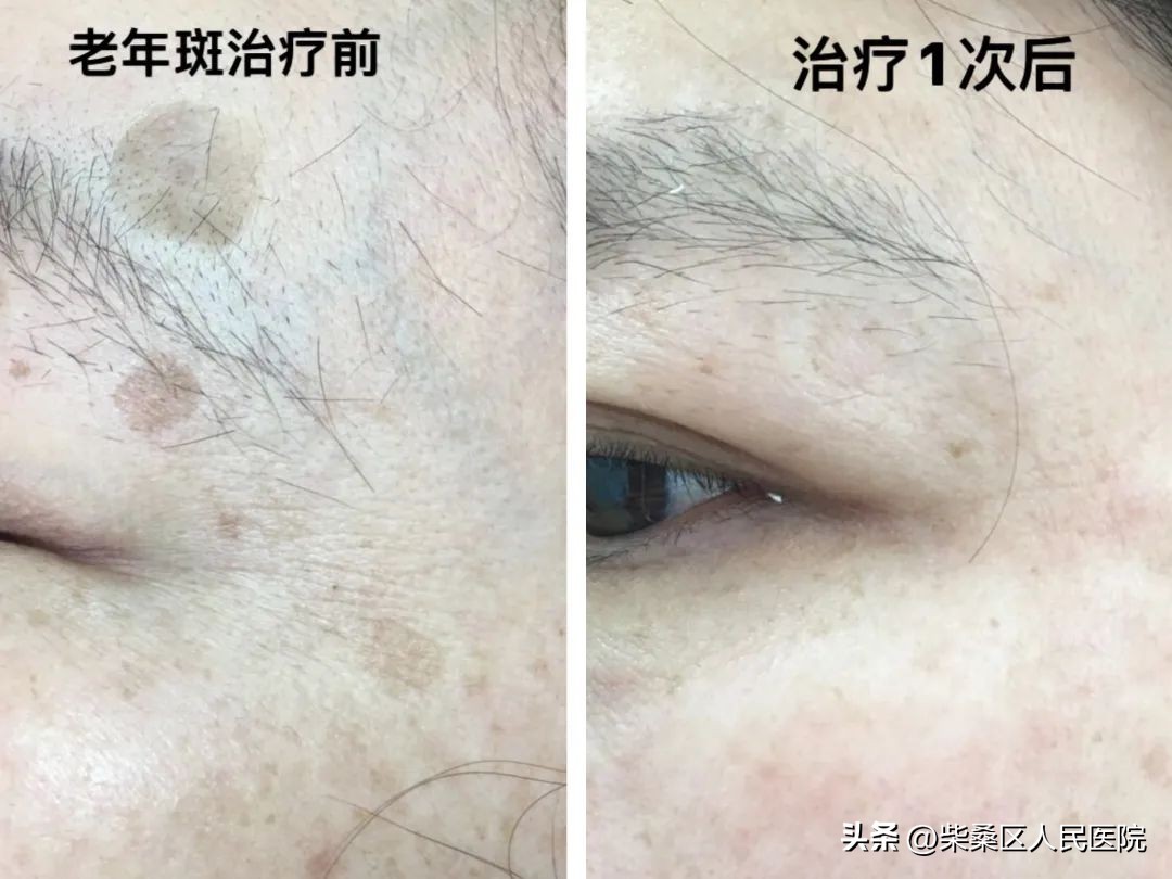 【医疗惠民】柴桑区人民医院3.8女神节优惠活动又来啦！