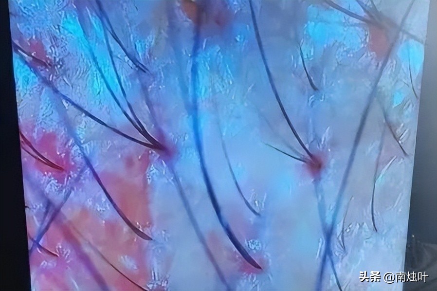 如何在三天内快速长20厘米头发,如何在一分钟内长5cm的头发