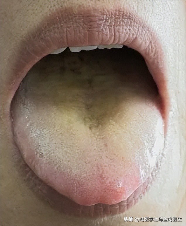 中医如何看大便不通畅的原因,大便不畅按什么穴位最好