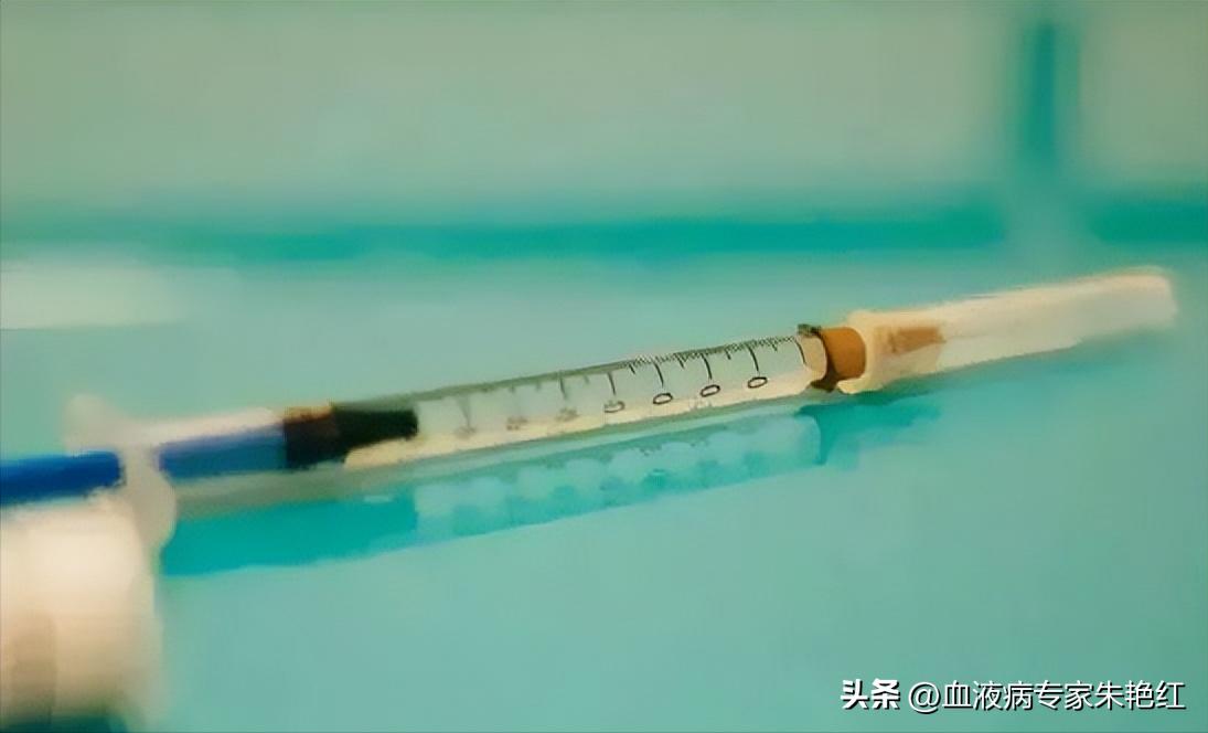 血小板减少症和mds的区别,mds血小板低是继发性还是原发性