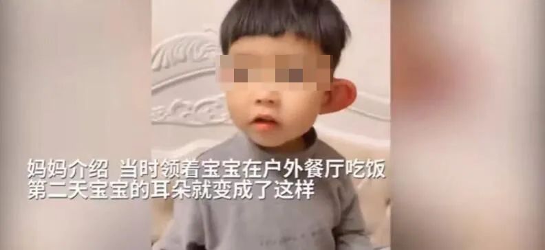 宝宝脸上被蚊虫叮咬几天还红肿,宝宝脸部被蚊虫叮咬出水泡化脓