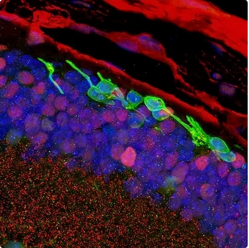 诱导多能干细胞发展历程,诱导多能干细胞的功能及优点