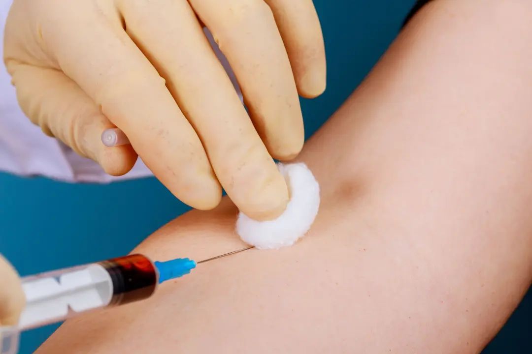 黄体酮都有哪些给药方式？