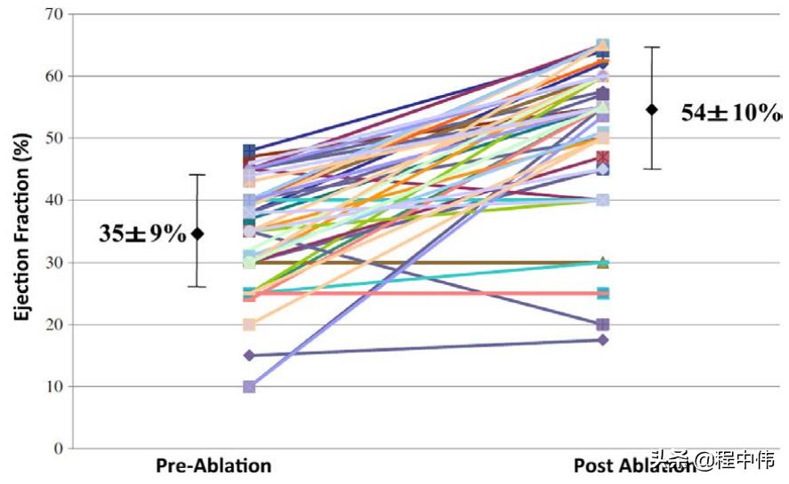 室性早搏鉴别诊断及治疗,心脏室性早搏怎么治