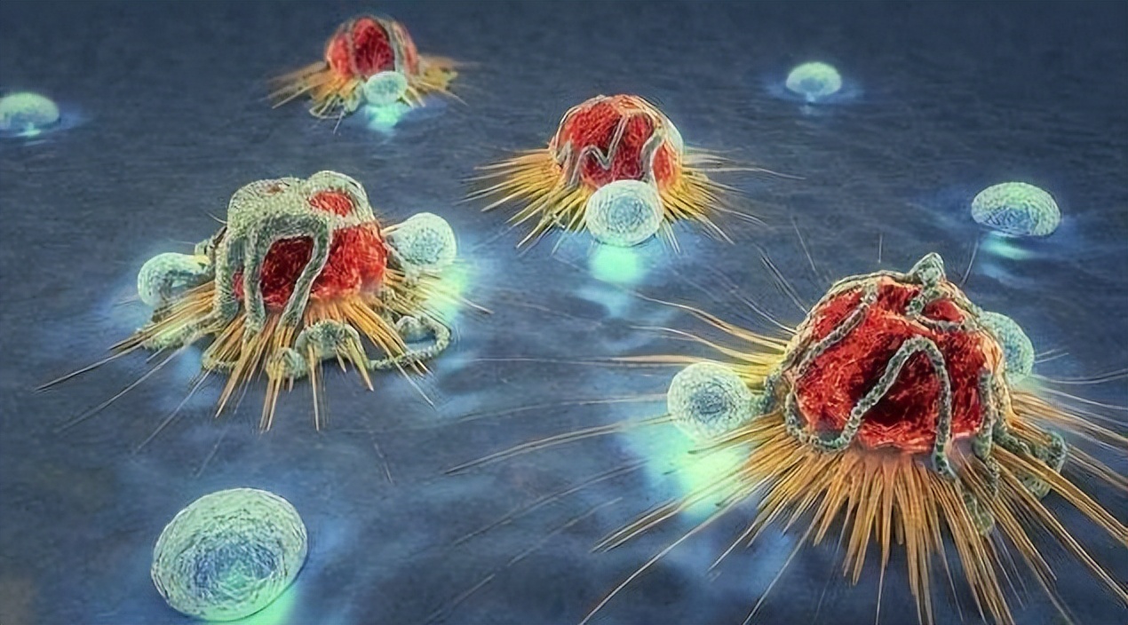 从炎症到癌症三种炎症别拖着,从炎症到癌症以下几种炎症不要拖