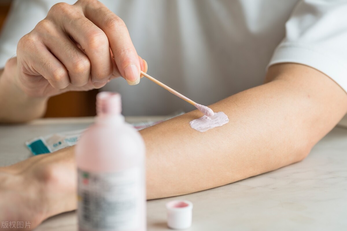 老年特应性皮炎瘙痒怎么办,老人皮痒是不好的征兆吗