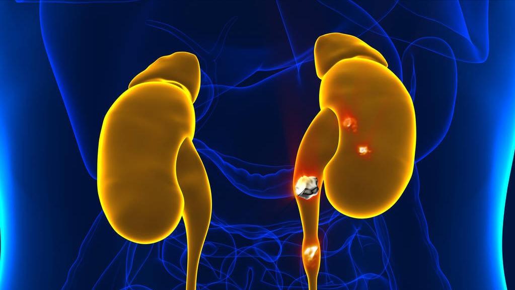 老年人缺钙该怎么办？想要强肾补钙关节好，试试这3个妙招