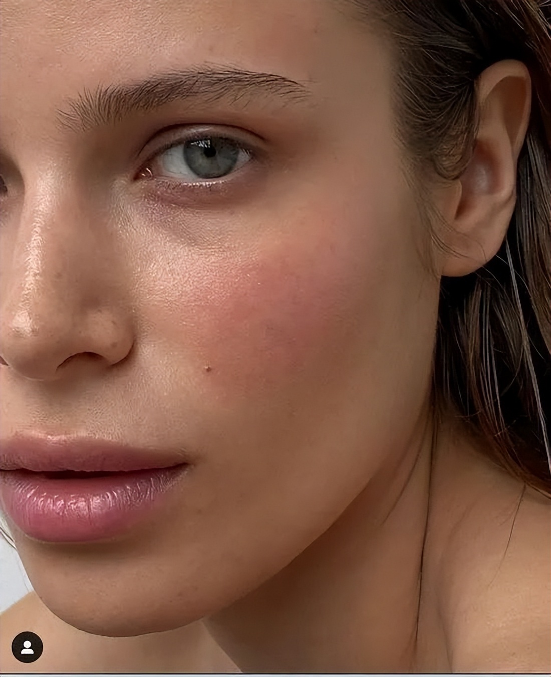 石原里美、Chloe都在用的祛痘、祛痘印方法 你不想知道吗？