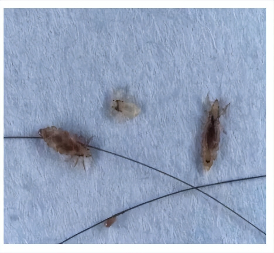 吸血臭虫虫卵,吸血虫臭虫是跳蚤吗