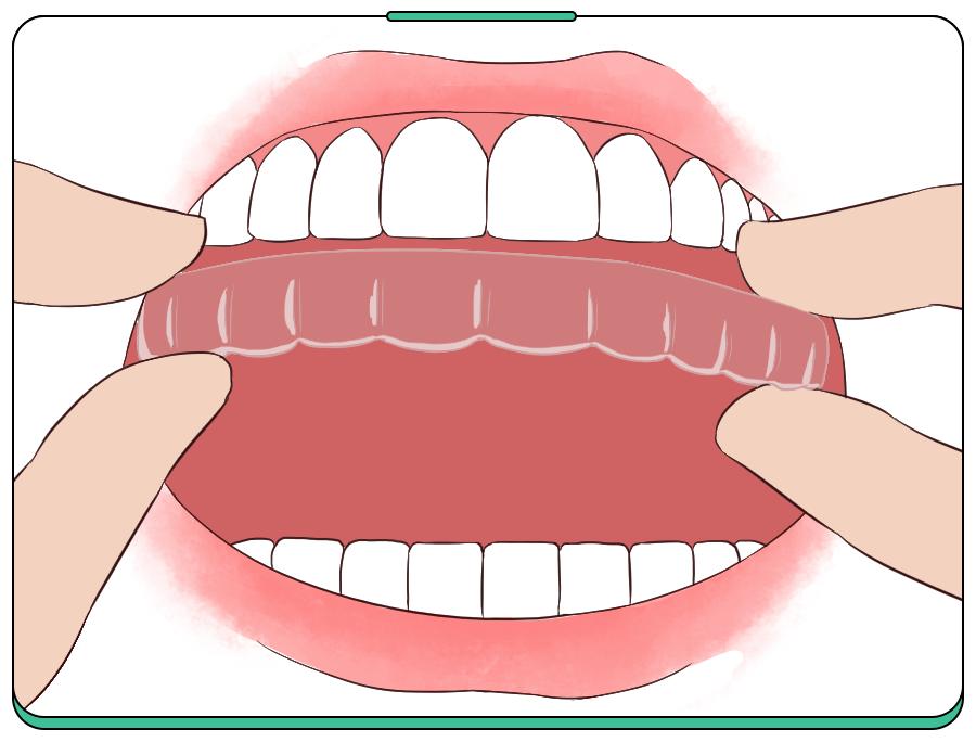 娃睡觉磨牙，不能放任不管！5大后遗症，毁掉牙齿毁脸型