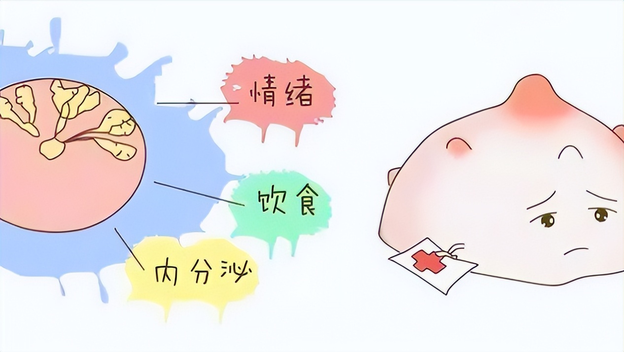 年轻女性乳腺囊肿有包块、突然疼痛？医生教你如何治疗