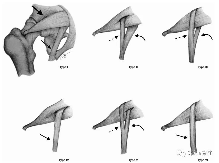 针灸治疗梨状肌综合征,一文了解贲门失弛缓症