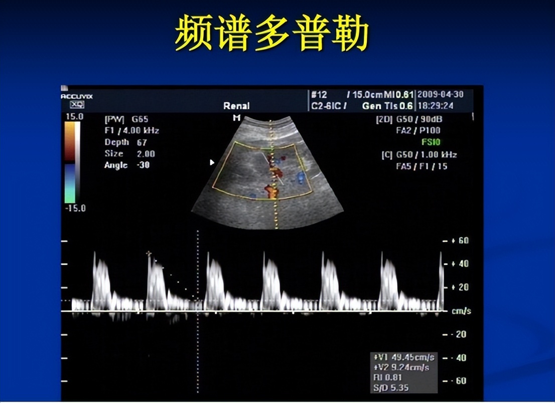 子宫性不孕症诊断与治疗,子宫发育不良性不孕确诊检查