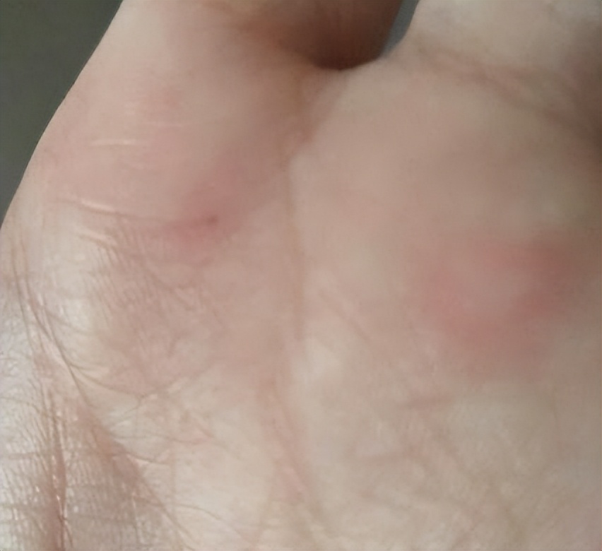 甲硝唑一瓶多少钱,甲硝唑多少钱一盒10粒装