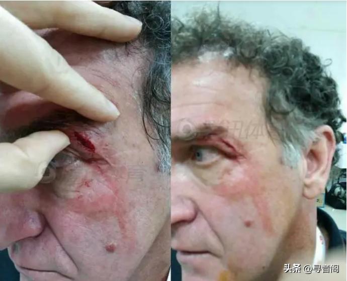 中超裁判顶级判罚,中超裁判频繁出现争议判罚