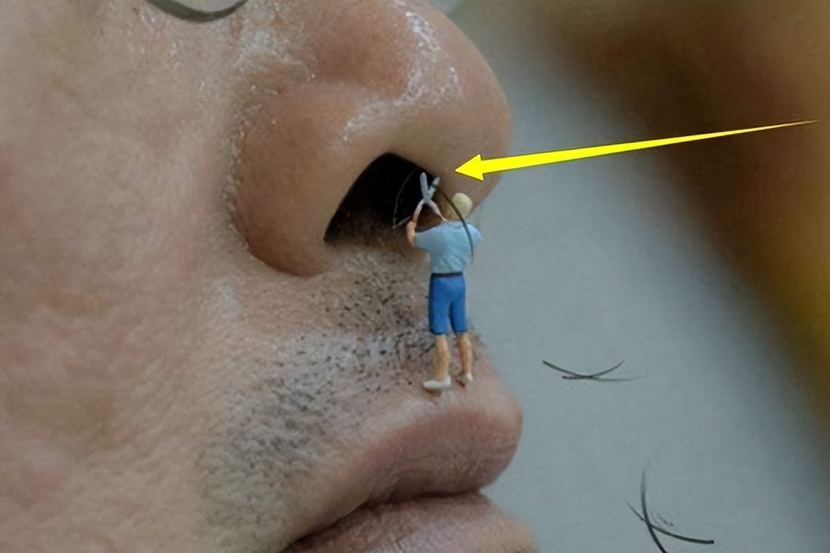 鼻毛窜出来该怎么解决,鼻毛窜出来后应该是剪掉还是拔掉