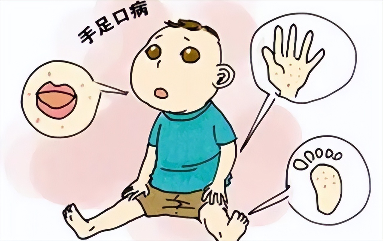 孩子淋雨起的疹子怎么办,小朋友淋雨