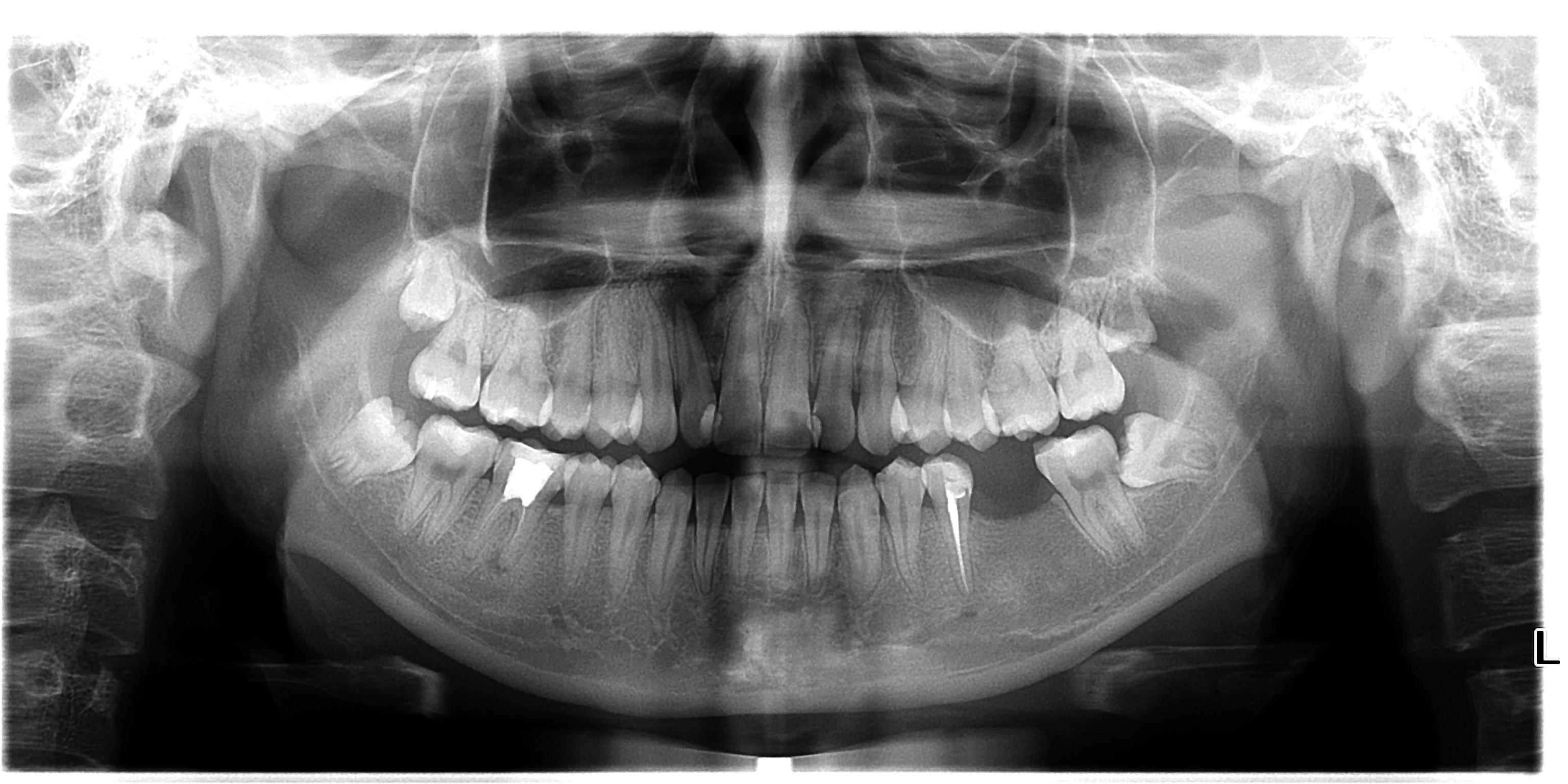 德国卡瓦全景机多少钱,德国卡瓦口腔设备