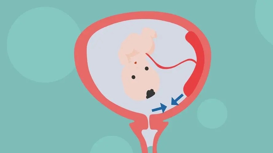 打过胎的女人和二婚有区别吗,打过胎的女人和离过婚的女人