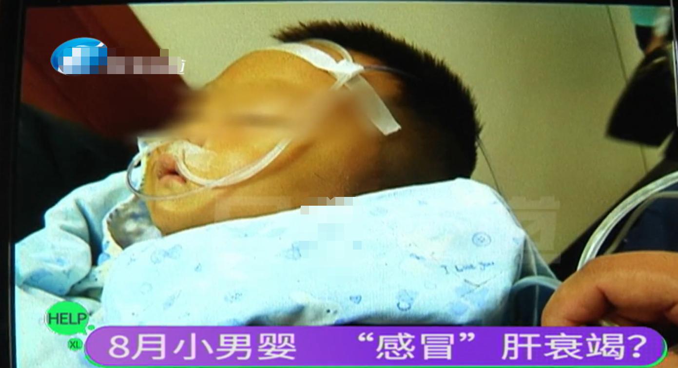 孩子把感冒药吃多咋办,小孩感冒吃错药肝衰竭