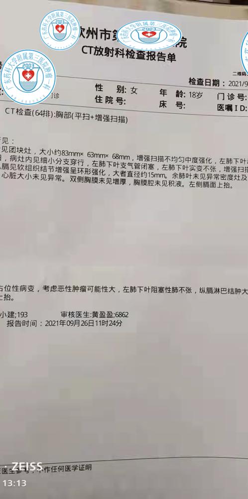 肺部肿瘤长在憩室里面,肺部5厘米的肿瘤要长多久