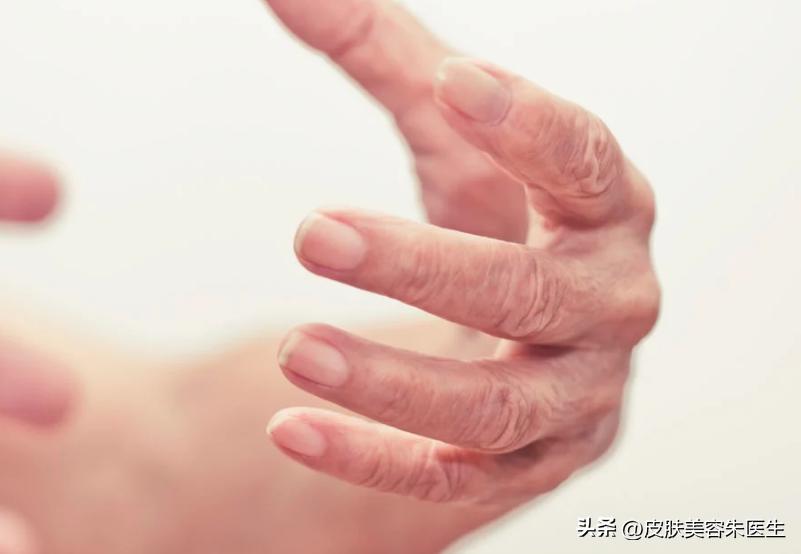 双手震颤吃什么药,双手麻痹怎么缓解