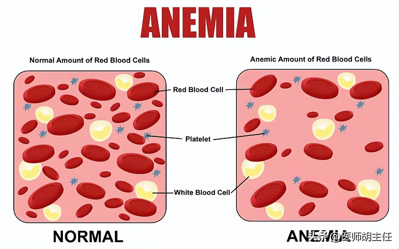 中老年人补充叶酸哪种牌子好,中老年白发补充叶酸有用吗