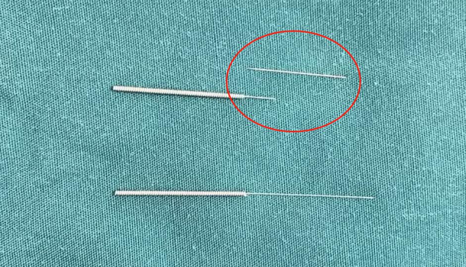 银针断在体内的征兆,银针断针处理