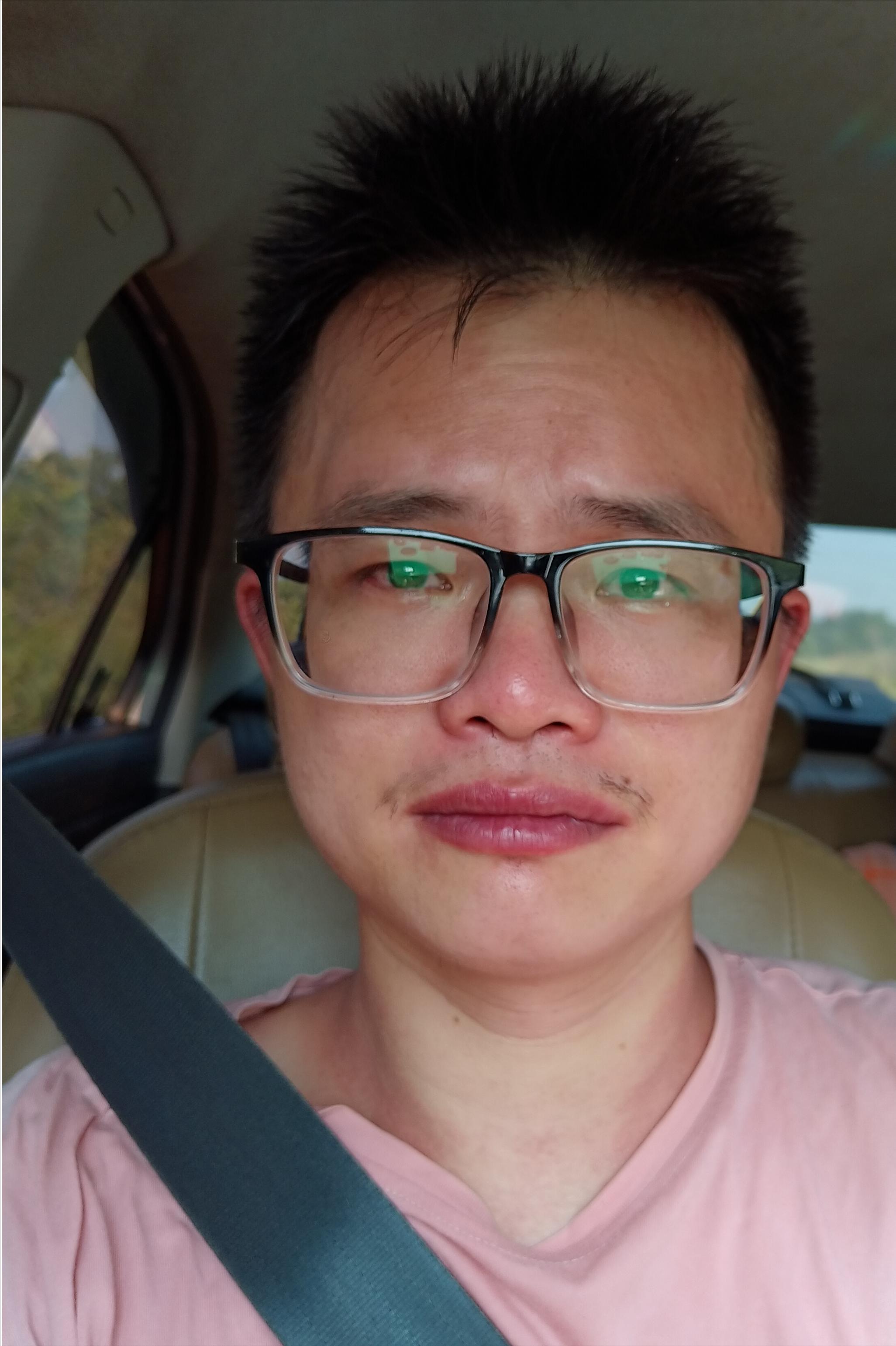 蜜蜂蛰了额头留下一片黑怎么办,我被蜜蜂蛰了