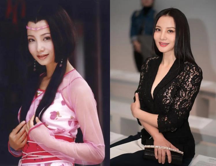 最近脸僵硬的女星,脸部变僵硬的女明星