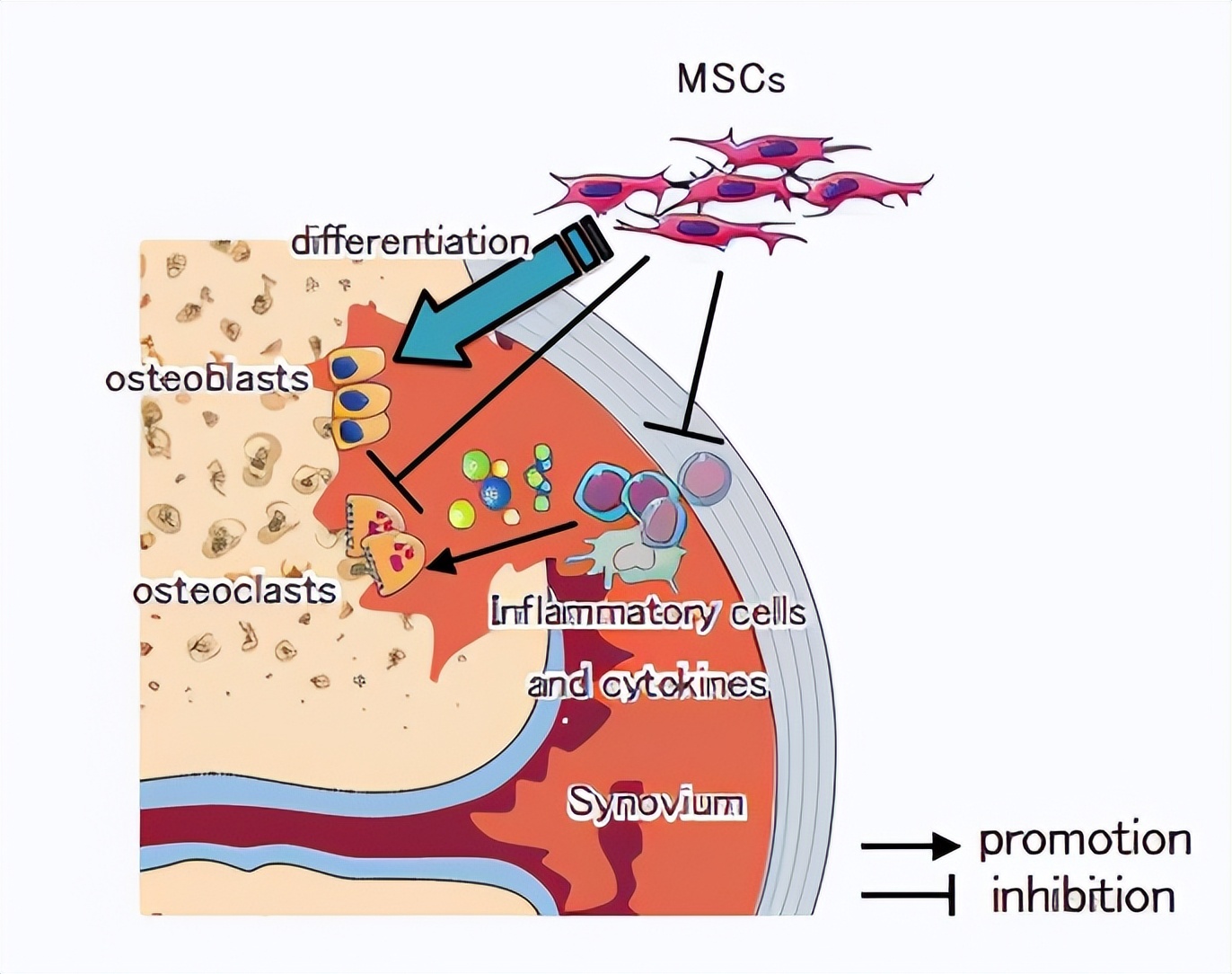 日本干细胞最佳治疗方法,日本干细胞最新临床治疗