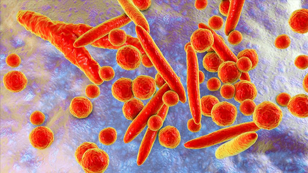 男性解脲支原体阳性影响备孕吗,夫妻有支原体阳性会影响怀孕吗