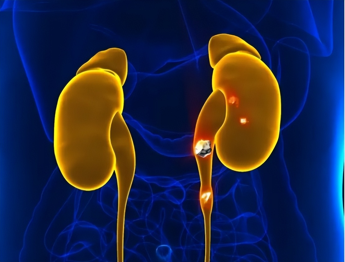 排尿很黄、异味很大？身体向你暗示的这5件事，可能与疾病有关