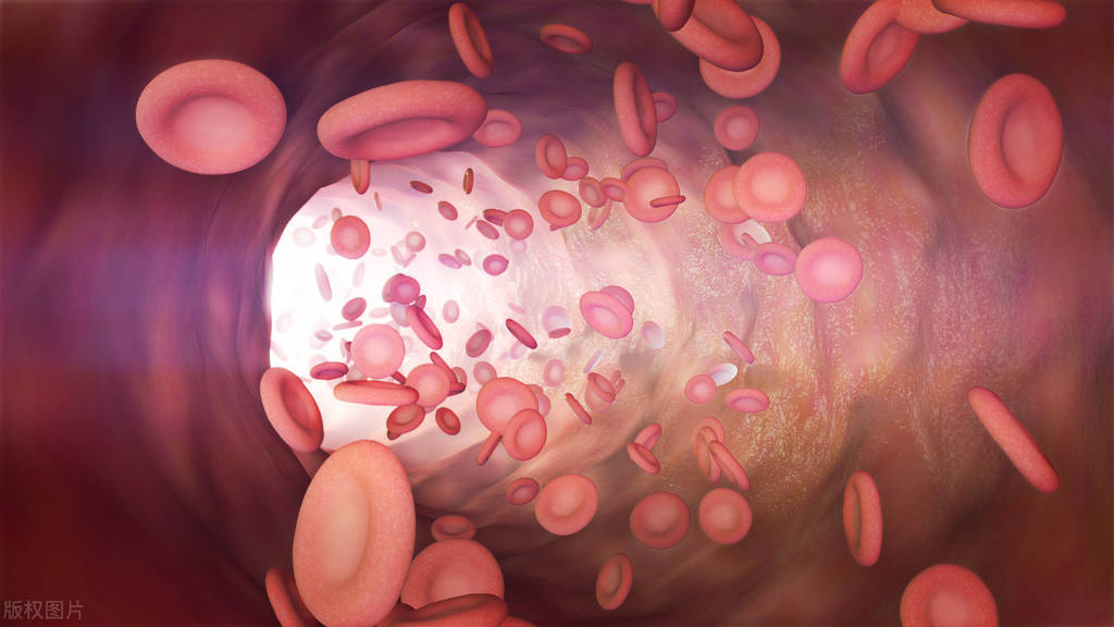 mds骨髓增生异常一个月就死了,慢性骨髓增生性疾病是mds吗