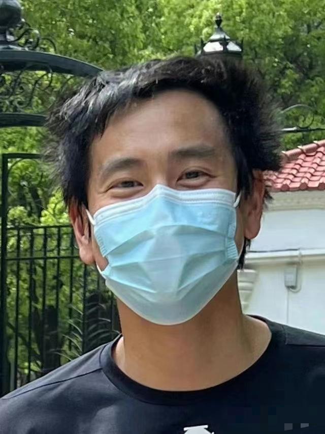 有哪些明星头发秃顶,秃顶明星发际线