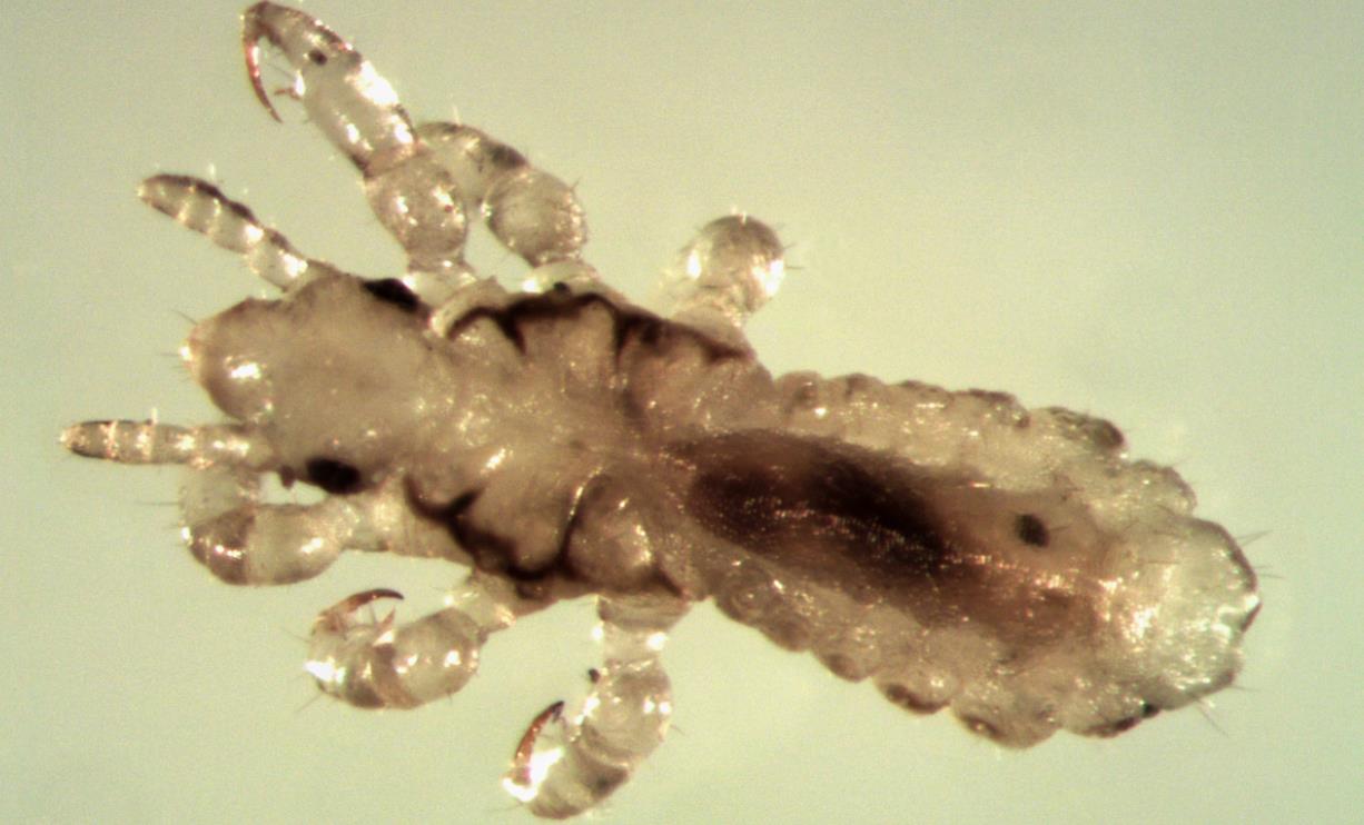 我搬进了低价公寓，洗澡时忘记带毛巾，用了房东提供的，染上阴虱