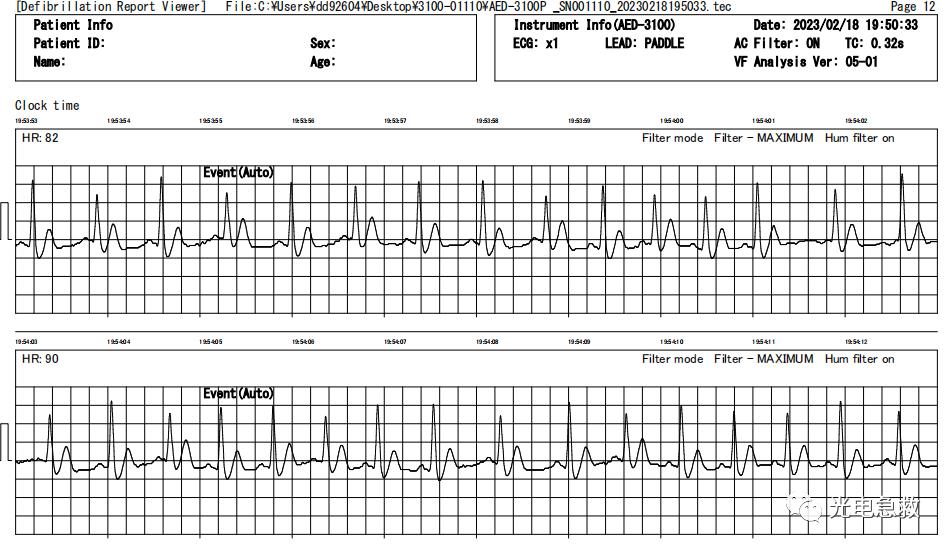 2004足球运动员心脏骤停事件,足球心脏骤停对手帮忙抢救