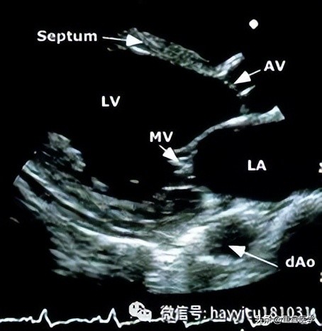 休克评估与处理课件,休克评估最有效指标